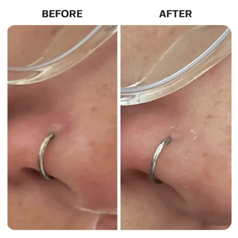 Piercing Aftercare Saline Gel